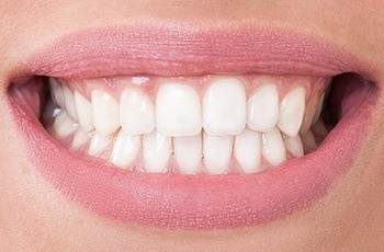 Closeup of healthy white smile after dental bonding