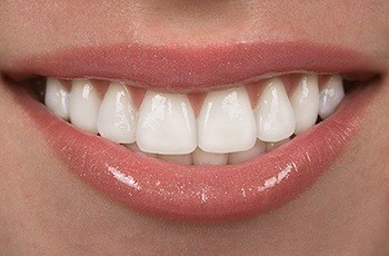 Closeup of bright white smile after teeth whitening