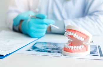 A closeup of dentures on a table