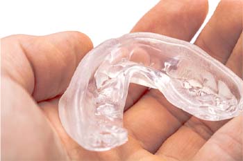 Mouthguard from an emergency dental office in Columbia