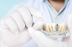 Columbia implant dentist holding dental implant restoration