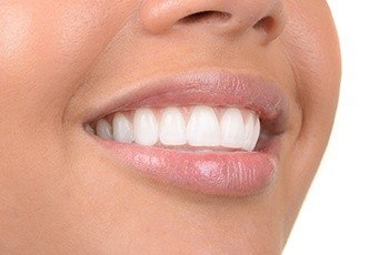 Closeup of healthy smile after ridge augmentation