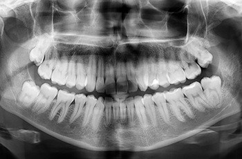 Digital x-rays on computer screen