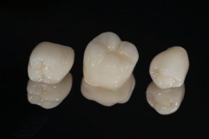 three dental crowns in Columbia against black background 