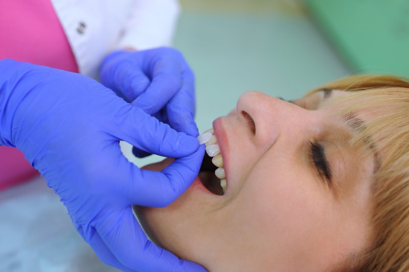 Lady receives veneer