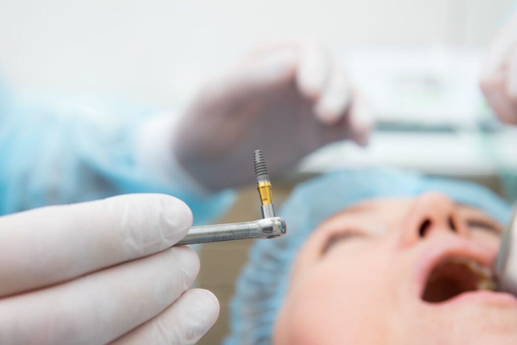 Dentist's gloved hands about to insert dental implant into patient's jaw