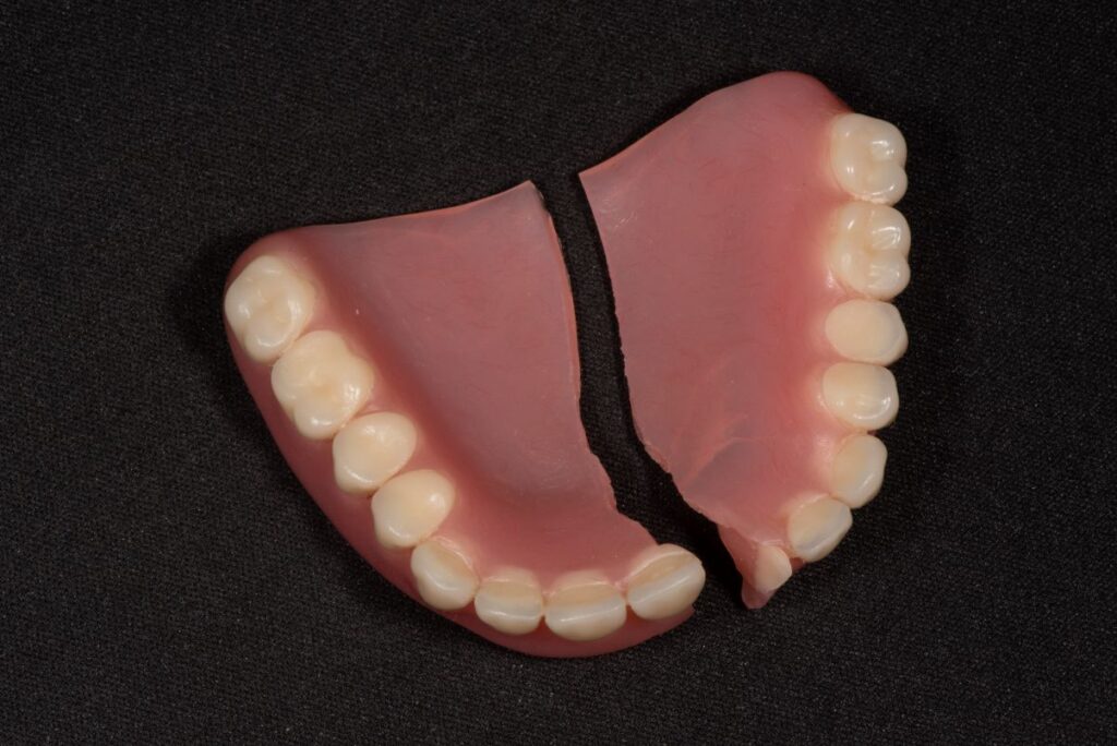 A broken denture
